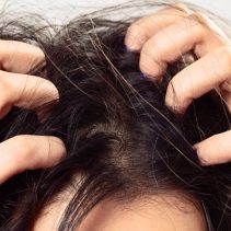 Understanding Scalp Health: Common Issues and Causes